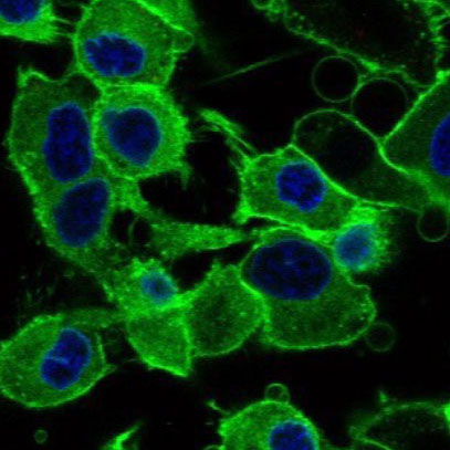 bright green microscopic cells