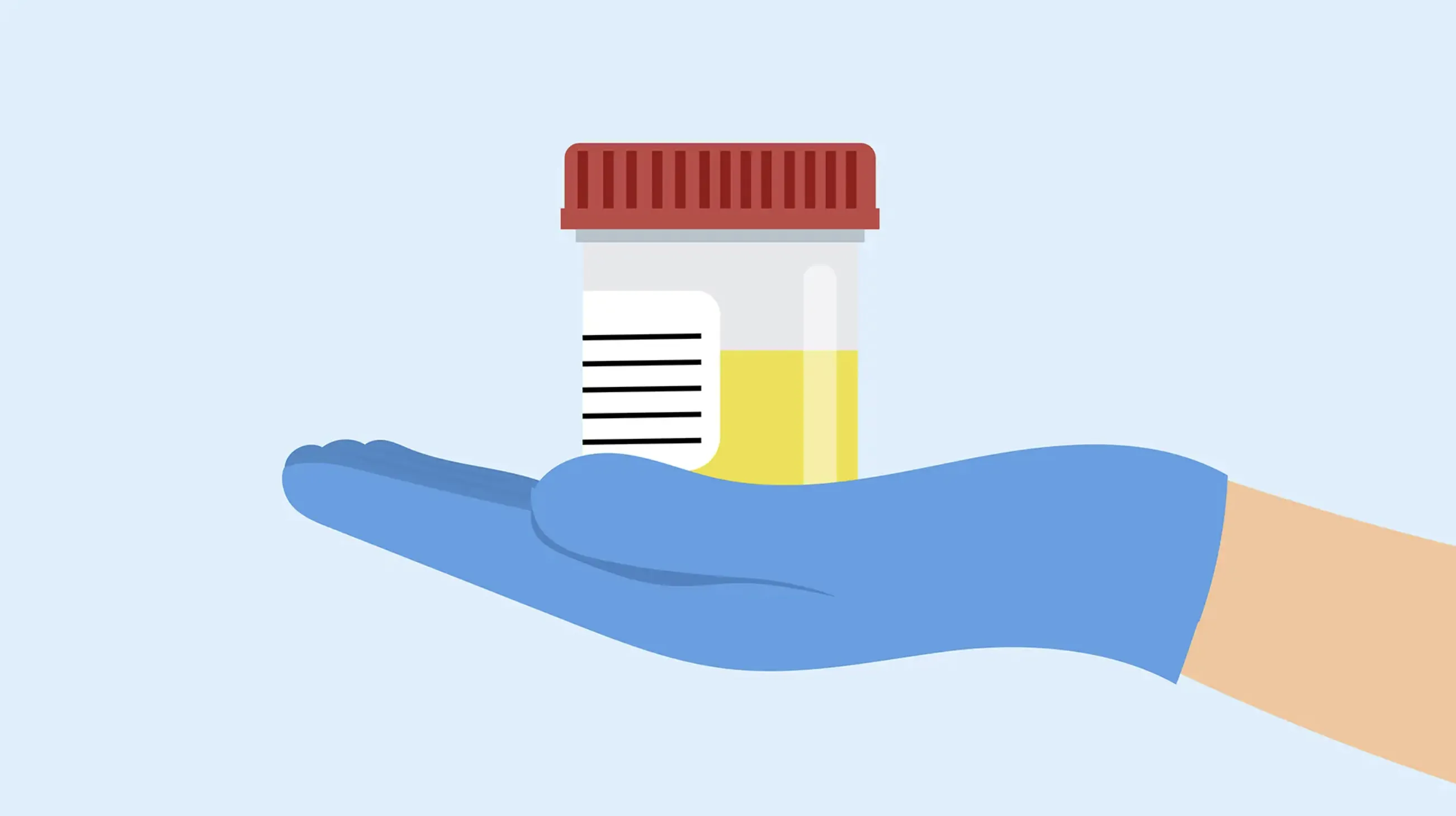 illustration of gloved hand holding urine sample in container